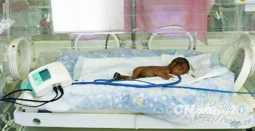 女婴被安置在保温箱里