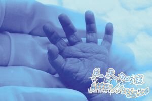 我市诞生最袖珍婴儿一斤二两(组图)