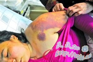 ����͵������Ů���Ⱪ��ʾ��(ͼ)