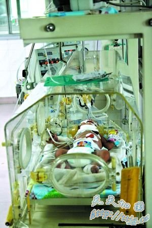 ��Ӥ�������ֶദ�п�����Ϊ19��ĸ����Ϊ(��ͼ)