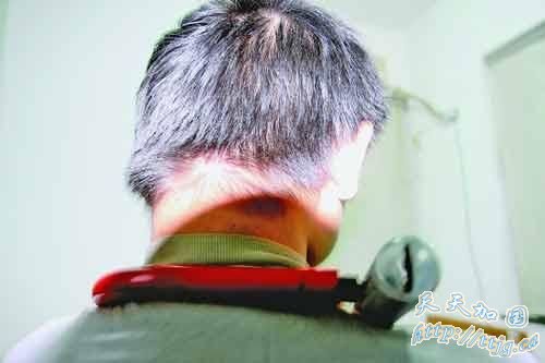 父亲给儿子脖子上锁称是为防止其偷钱(图)