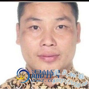 ����1�������˴�ҽԺ���� �������Ե�Уɱ��