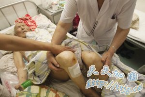 86����������Ժ�ڱ�����ҧ�� �˿�����¶��